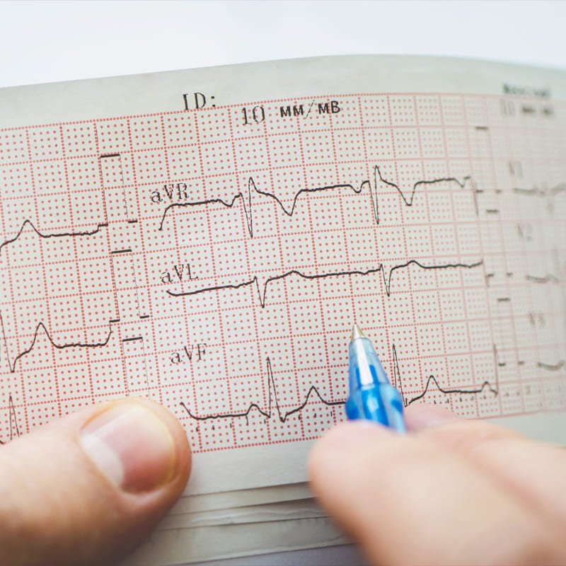 elettrocardiogramma-farmacia